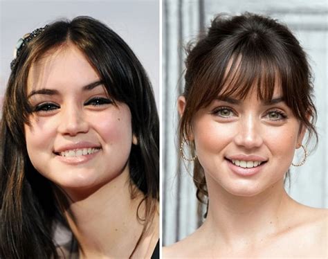 ana de armas before and after surgery|ana de armas before.